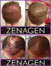 Load image into Gallery viewer, ZENAGEN Revolve Conditioner Hair Loss Treatment Conditioner (Unisex), 16 oz
